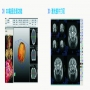 數字化醫院解決方案-醫學影像系統(PACS)